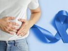 O câncer de intestino é conhecido como câncer colorretal porque engloba os tumores surgidos na parte do intestino grosso chamada cólon e reto