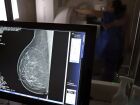 Mato Grosso do Sul tem 1,3 mil mulheres na fila por mamografia no SUS, com espera média de 24 dias, segundo dados de junho deste ano.