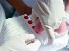 O teste do pezinho é um dos métodos usados para diagnosticar doenças raras