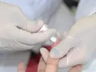 Diagnóstico de hepatite ocorre nas Unidades Básicas de Saúde municipais, por meio do teste rápido. 