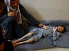 Fome atinge nível mais crítico em Gaza e pressões por reconhecimento da Palestina crescem