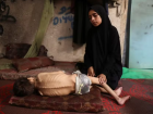 Fome extrema: mãe palestina Samah Matar ao lado de seu filho desnutrido Youssef, que sofre de paralisia cerebral, em uma escola onde eles se abrigam na Cidade de Gaza, em 24 de julho de 2025.