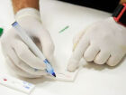 Campanha contra hepatites virais oferece testes, vacinação e orientações em unidades de saúde de Campo Grande