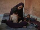 Naima Abu Ful segura seu filho desnutrido de 2 anos, Yazan, em sua casa no campo de refugiados de Shati, na Cidade de Gaza  