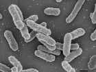 Colônia de bactérias Yersina pestis. (Foto: Muhsin Özel, Gudrun Holland, Rolf Reissbrodt/RKI)