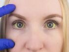 Um dos sintomas mais conhecidos é a icterícia, esse amarelado nos olhos 