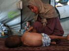 Imagem desta terça-feira, 24, mostra Hidaya, mãe palestina de 24 anos, ao lado do seu filho, Mohammed al-Mutawaq, de 1 ano e 6 meses, em uma barraca para refugiados na Faixa de Gaza. Bebê tem sinais de desnutrição e está doente 