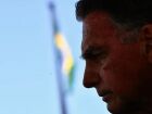 Bolsonaro solicita ao STF autorização para deixar a prisão domiciliar e realizar exames médicos em Brasília, após cirurgia no intestino.