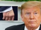 O presidente dos Estados Unidos, Donald Trump, chamou atenção nesta sexta-feira (22) ao aparecer com uma camada grossa de maquiagem na mão direita. 