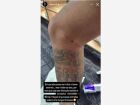 Neymar posta foto da perna machucada após duelo com o Fluminense.