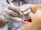 A ABO-MS abrirá vagas para um procedimento inovador de implantes dentários, com resultados em até 10 dias
