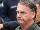 Jair Bolsonaro deixou o hospital em Brasília após melhora no quadro clínico e seguirá com acompanhamento médico por câncer de pele