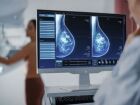 Antes indicada até os 69 anos, a mamografia passará a ser oferecida no SUS a quem tem até 74 anos 