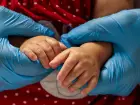 Brasil inclui terapia gênica para AME no SUS
