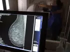 Pacientes com câncer de mama têm direito a benefícios do INSS, saque do FGTS e isenção de imposto de renda; legislação garante início do tratamento em até 60 dias após o diagnóstico.