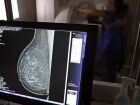 Falta de acesso a mamógrafos limita prevenção do câncer de mama