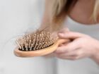 Queda de cabelo é uma queixa muito comum nos consultórios de dermatologistas  