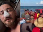 Agredido em Porto de Galinhas passa por cirurgia em MT 