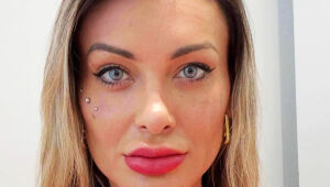 Andressa Urach fez a mudança na cor dos olhos