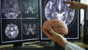 OMS alerta que maioria dos países não está preparada para enfrentar avanço de doenças neurológicas