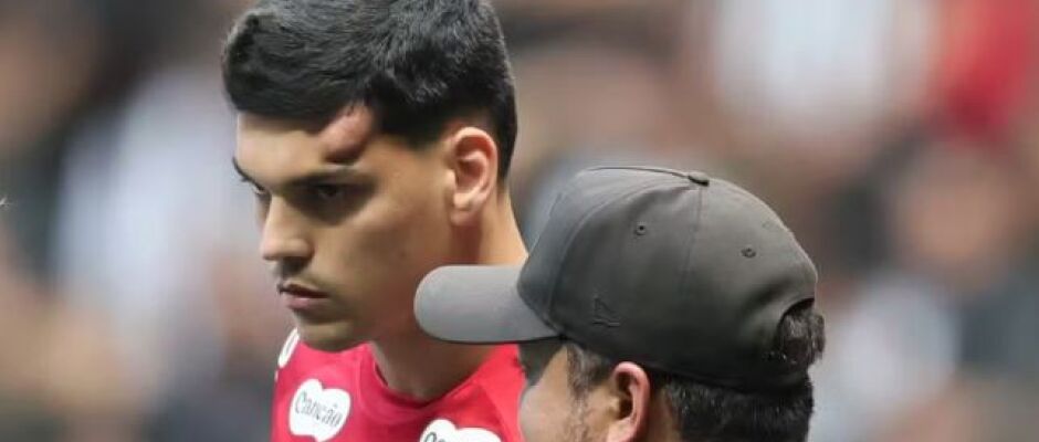Santos perde Gabriel Brazão para clássico contra o São Paulo por protocolo de concussão
