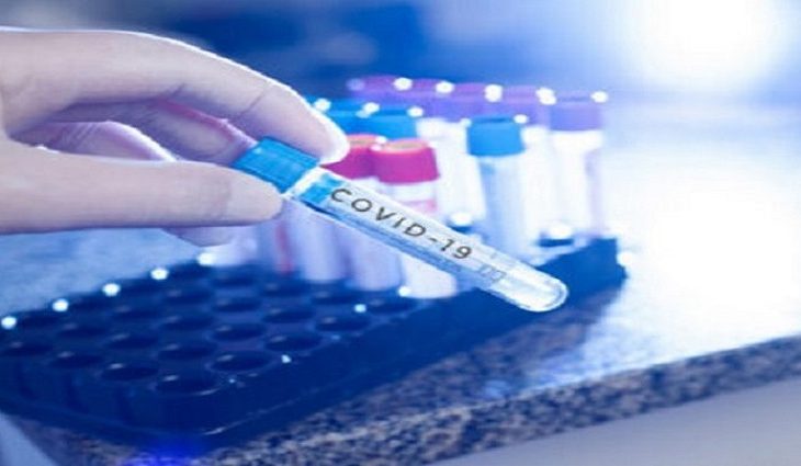 Conforme o Boletim Covid 19 deste sábado (26), foram registrados 638 novos casos em Mato Grosso do Sul