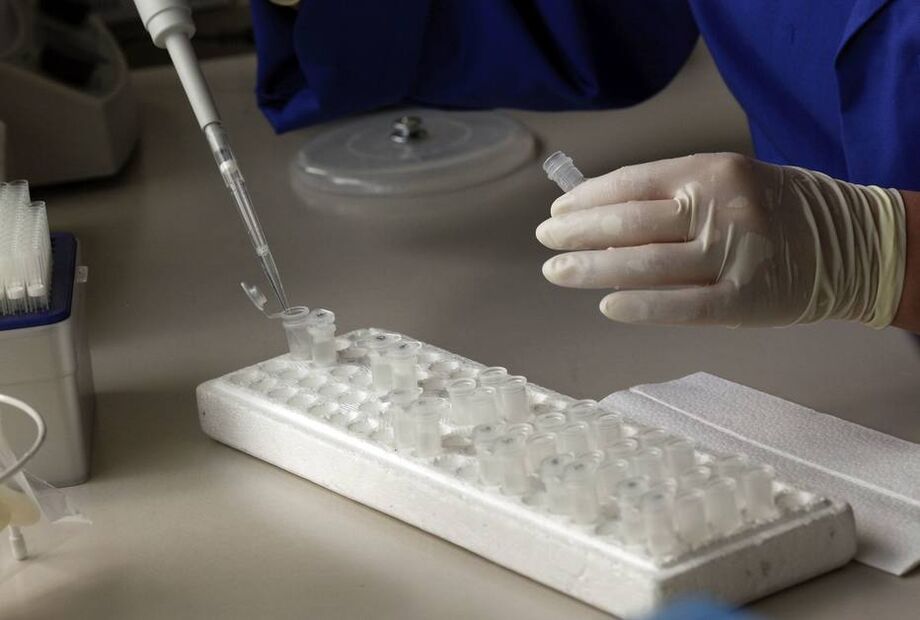 Novo estudo indica que não é possível o novo coronavírus infectar óvulos e que a fertilização in vitro pode ser segura para mulheres com covid-19