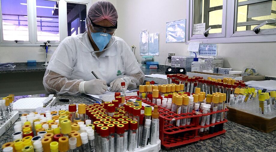 Com equipamentos modernos, o Laboratório Central de Saúde Pública (Lacen), da Secretaria de Estado de Saúde de Mato Grosso do Sul (SES/MS), foi responsável pela realização de mais de 131 mil testes 'padrão ouro' (RT-PCR)