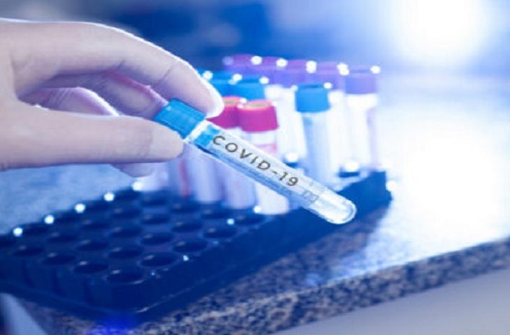 Em Mato Grosso do Sul, são 431 pessoas internadas, sendo duas de outros Estados