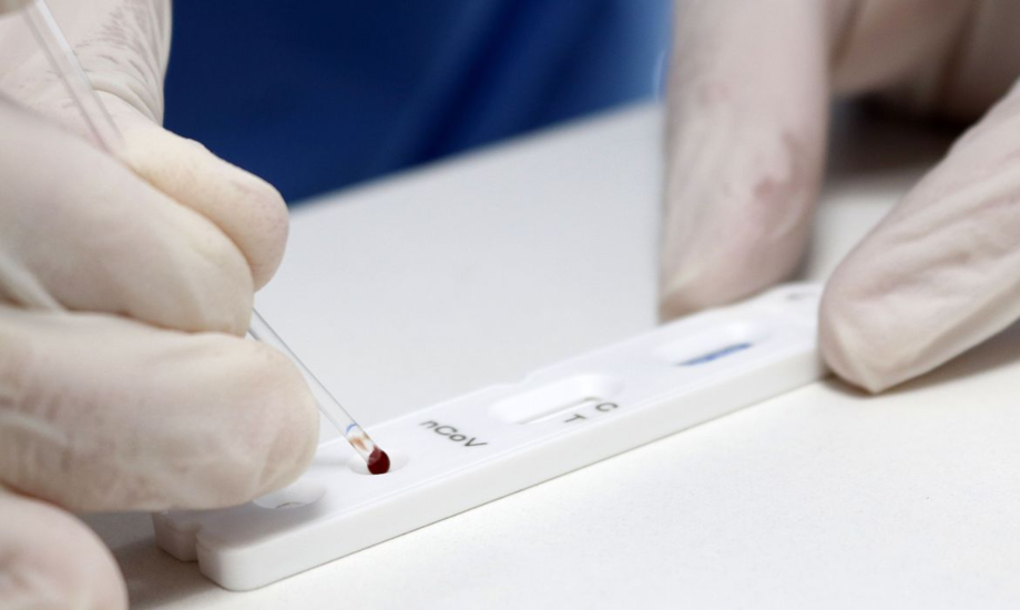 O número de pessoas infectadas pelo vírus desde o início da pandemia atingiu 6.674.999