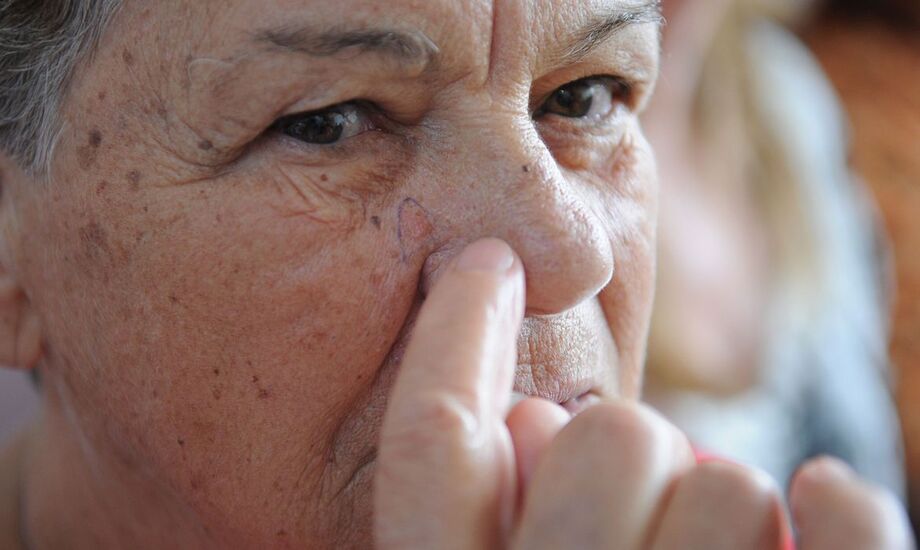 A Fundação do Câncer alerta para a prevenção do câncer de pele na campanha Dezembro Laranja