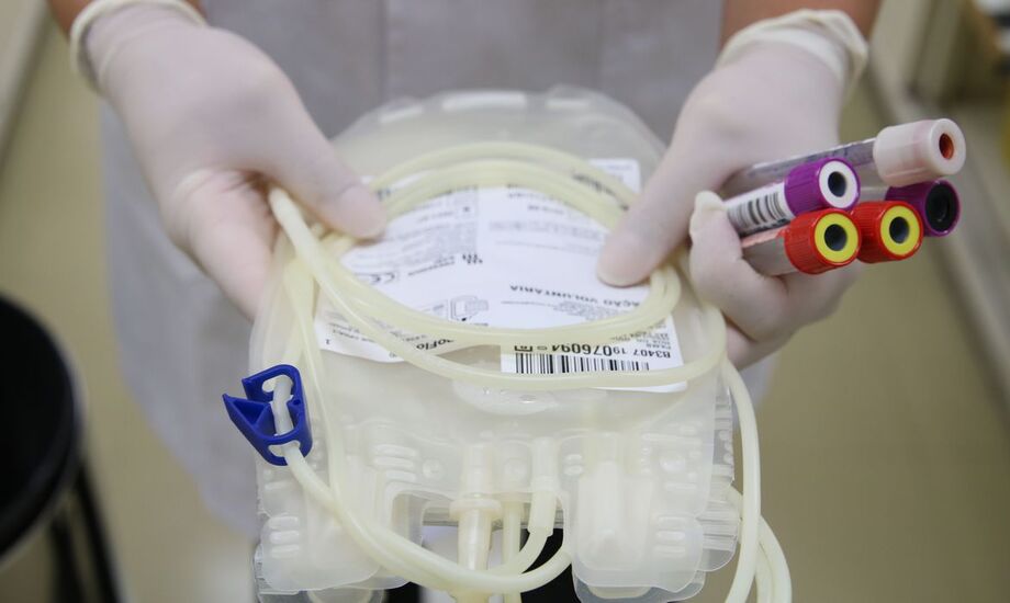 O transplante de medula óssea é a cura para várias doenças, como leucemia e anemia falciforme, doenças hematológicas com defeitos genéticos
