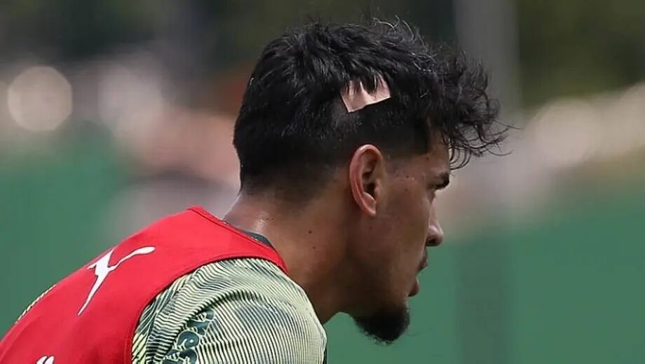 Gómez treinou com curativo na cabeça após corte sofrido na terça-feira