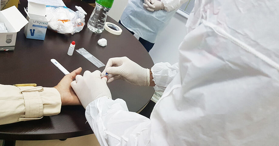Do início da pandemia até agora, o Estado de Mato Grosso do Sul registrou 175.973 casos confirmados de coronavíru