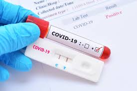 Teste Covid-19
