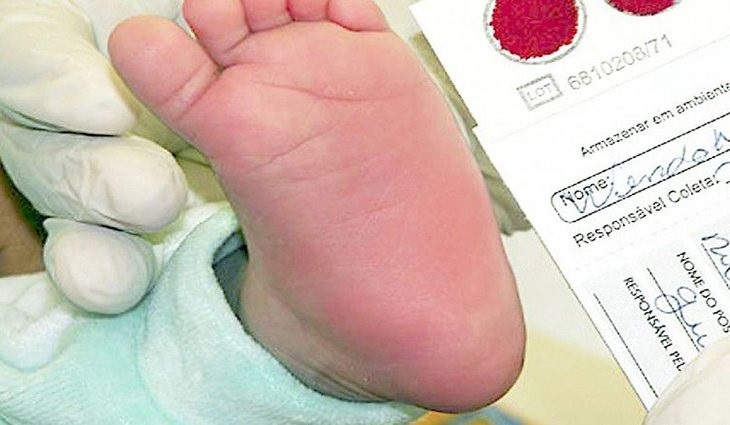 A Triagem Neonatal Biológica ou Teste do Pezinho que é realizada pelo SUS detecta sete patologias