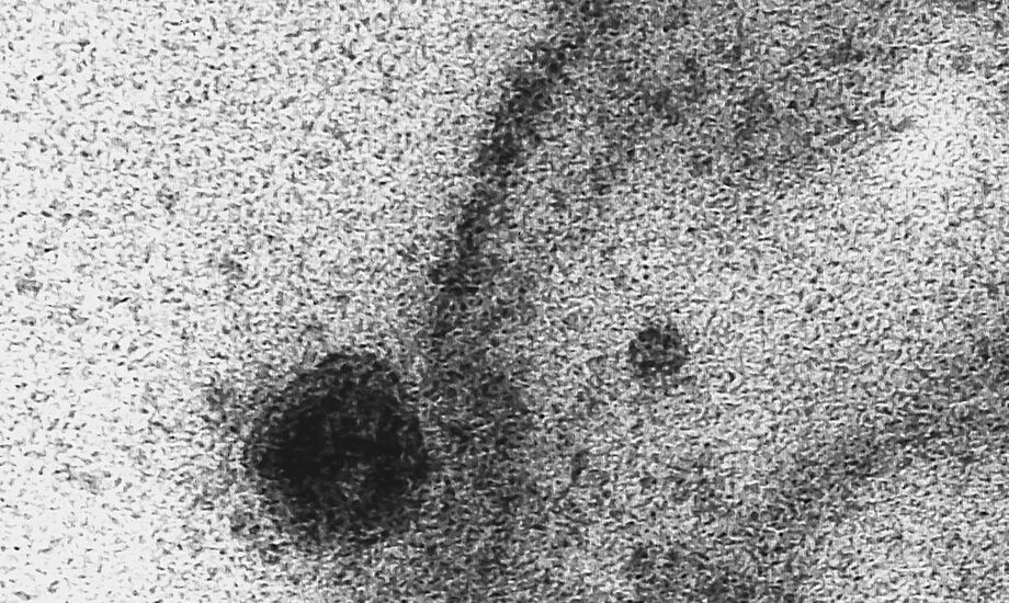 O material então foi submetido a análises moleculares para identificação da presença do vírus