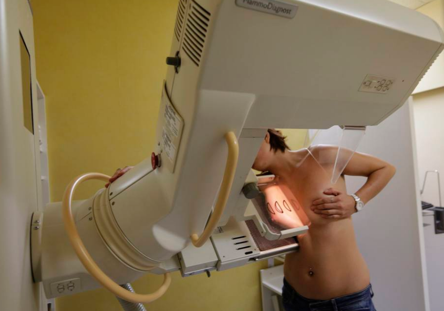 Mamografia de rotina deve ser feita antes da vacinação contra a covid ou quatro semanas após a segunda dose