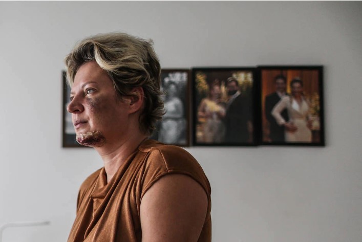 Joice Hasselmann em seu apartamento em Brasília; deputada diz não se lembrar de mais nada até acordar ensanguentada no chão