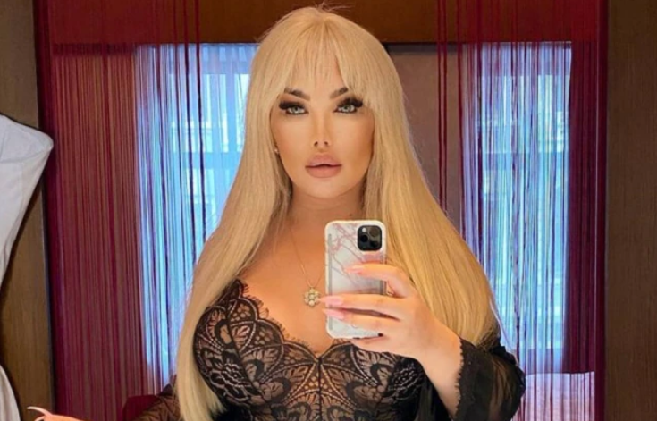 A trans Jessica Alves, antes conhecido como Ken humano, fará mais uma cirurgia de mudança de sexo
