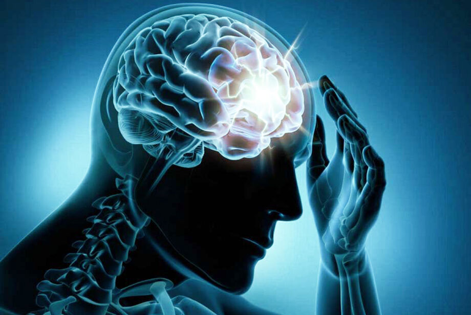A epilepsia é uma doença neurológica
