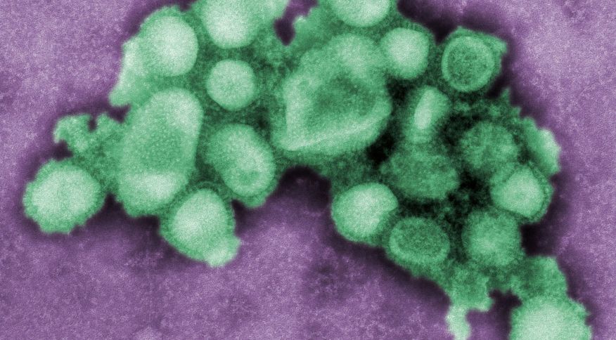 Vírus da Influenza