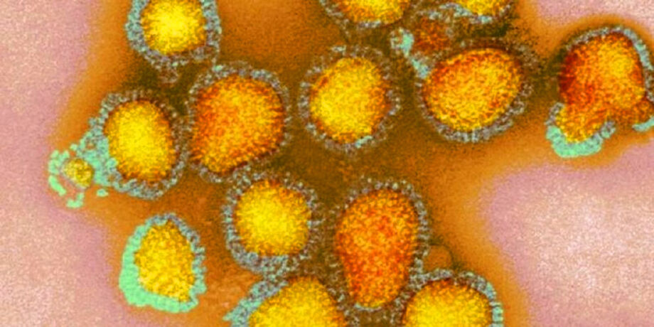 Dados atualizados da Secretaria Municipal de Saúde (Sesau), aponta que em dezembro, houveram 41 casos confirmados do vírus Influenza A/H3N2 em Campo Grande