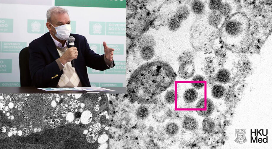 O secretário falou sobre a Omicron no Estado