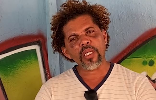 Givaldo é morador de rua