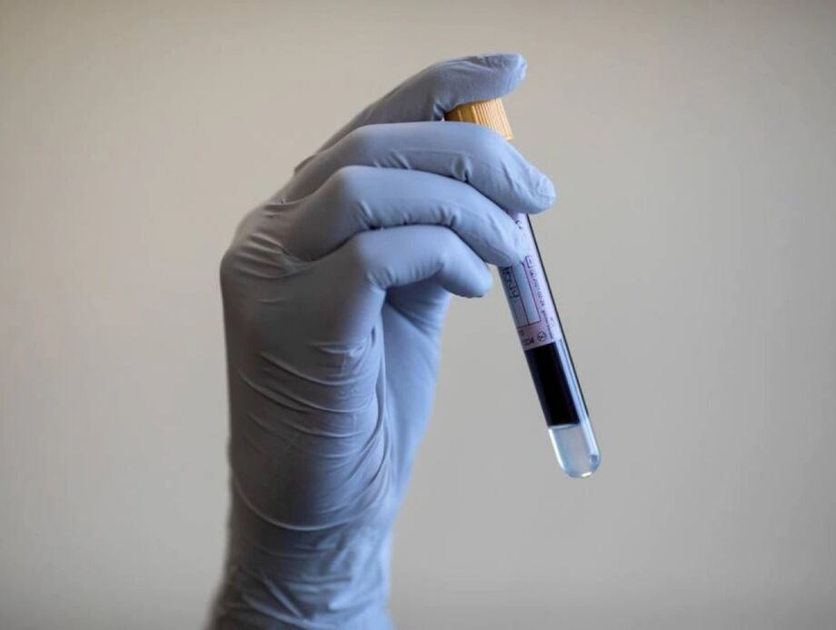 A reação seria similar à provocada na Síndrome Inflamatória Multissistêmica