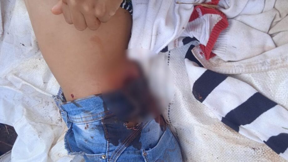 Povo Guarani Kaiowá sofre ataques após retomarem território Guapoy, em Amambai (MS)