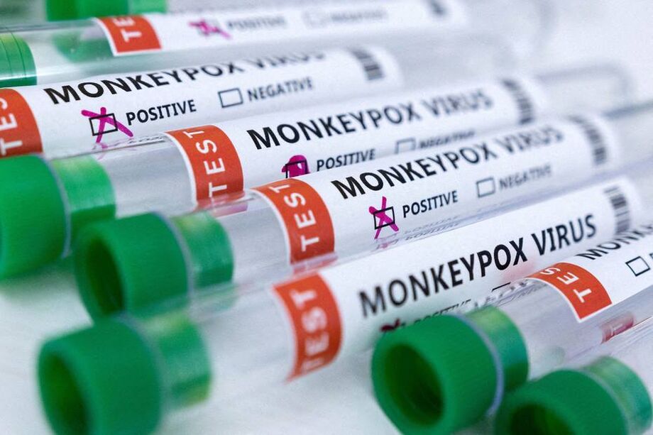 Teste para detecção de monkeypox, considerada emergência de saúde pública pela OMS.