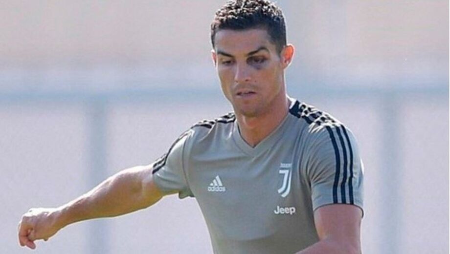 Cristiano Ronaldo com olho roxo