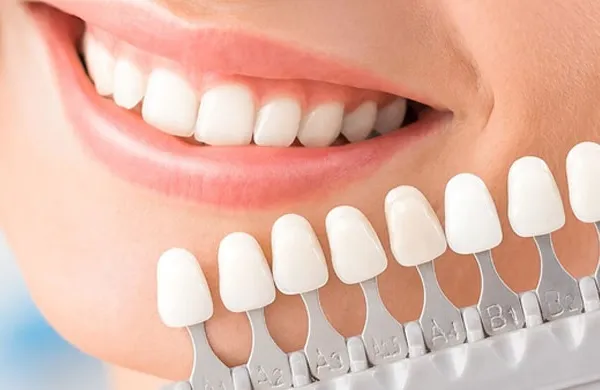 As facetas dentárias